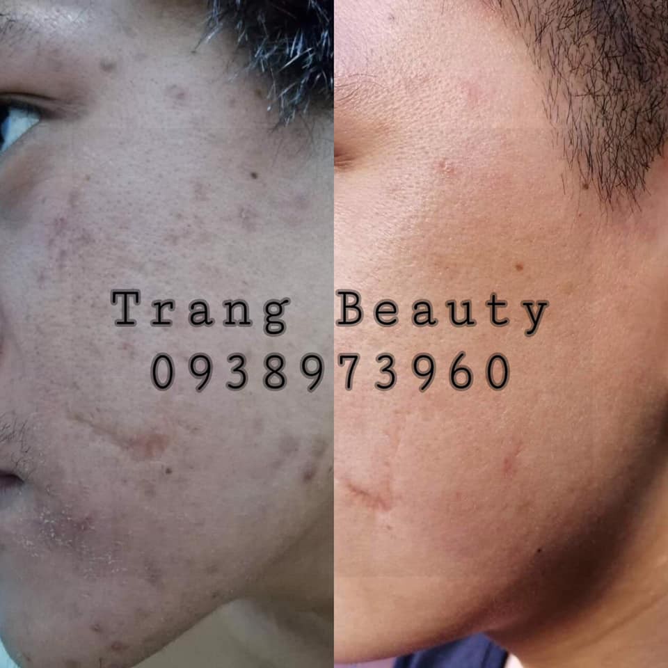 Thuốc Bắc Tái Tạo Da