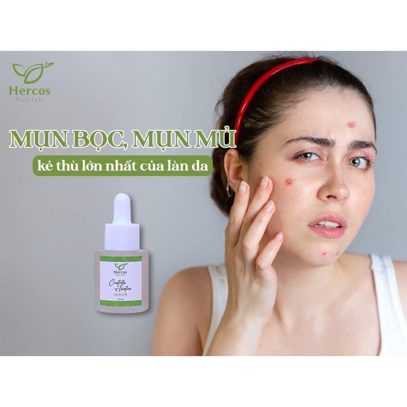 SERUM RAU MÁ TRÀM TRÀ