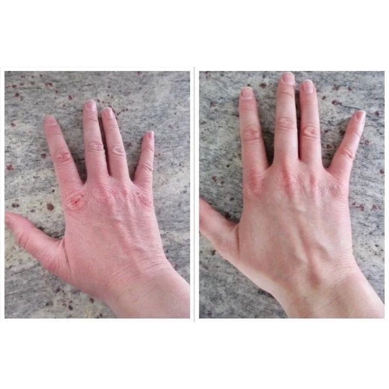 KEM DƯỠNG DA TAY KHÔ, NỨT DERMAL THERAPY HAND BALM 50G CHÍNH HÃNG