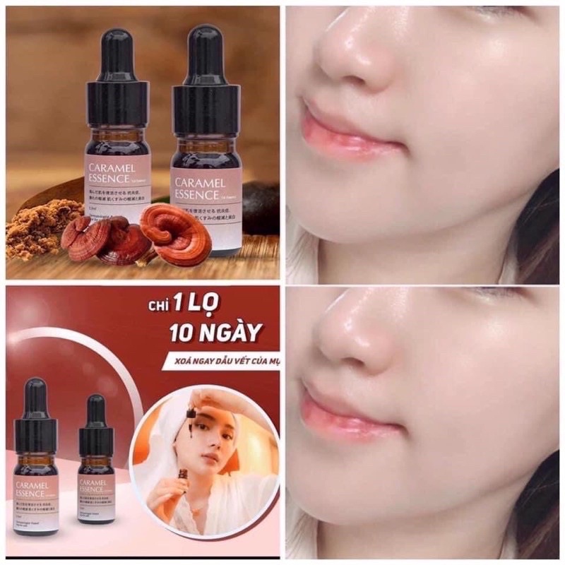 [Mua 2 tặng 1] Serum caramel essence 5ml ngừa mụn