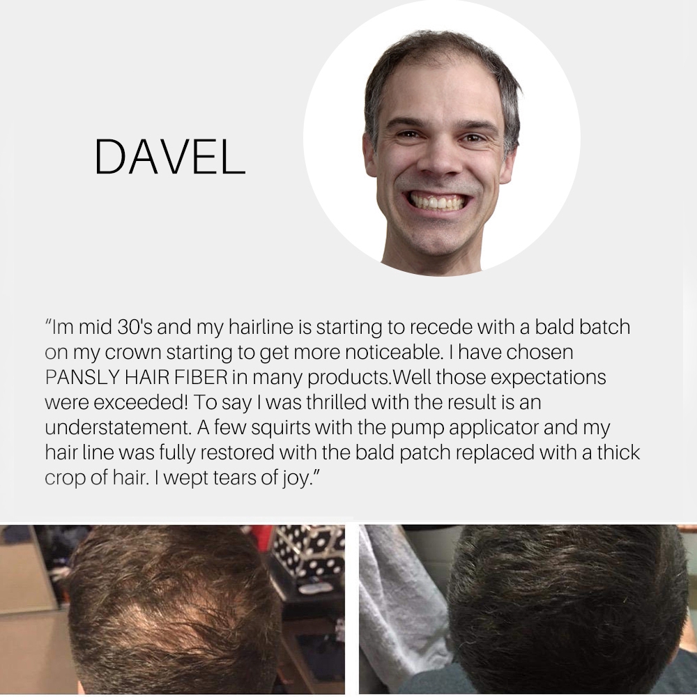 Bột che khuyết điểm, giúp làm dày tóc và chống rụng tóc hiệu quả | BigBuy360 - bigbuy360.vn