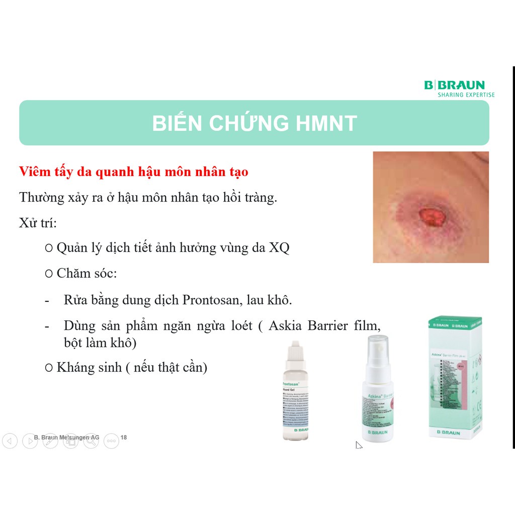 ✅ [HỘP 30 TÚI] Túi Phân Hậu Môn Nhân Tạo 1 Mảnh- B.Braun Proxima (Sử Dụng Kẹp), Braun (Đức), Túi Phân -VT0600