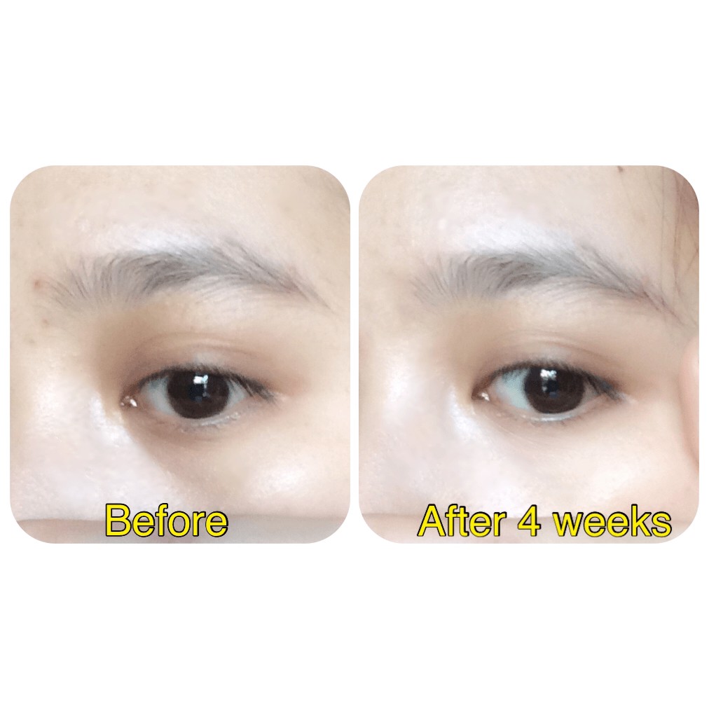 Kem Dưỡng Mắt Meishoku Placenta Medicated Whitening Eye Cream