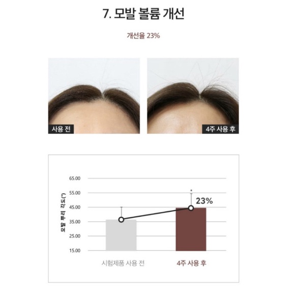 Dầu gội men bia chống rụng tóc DERMA FACTORY ANTI HAIR LOSS SHAMPOO