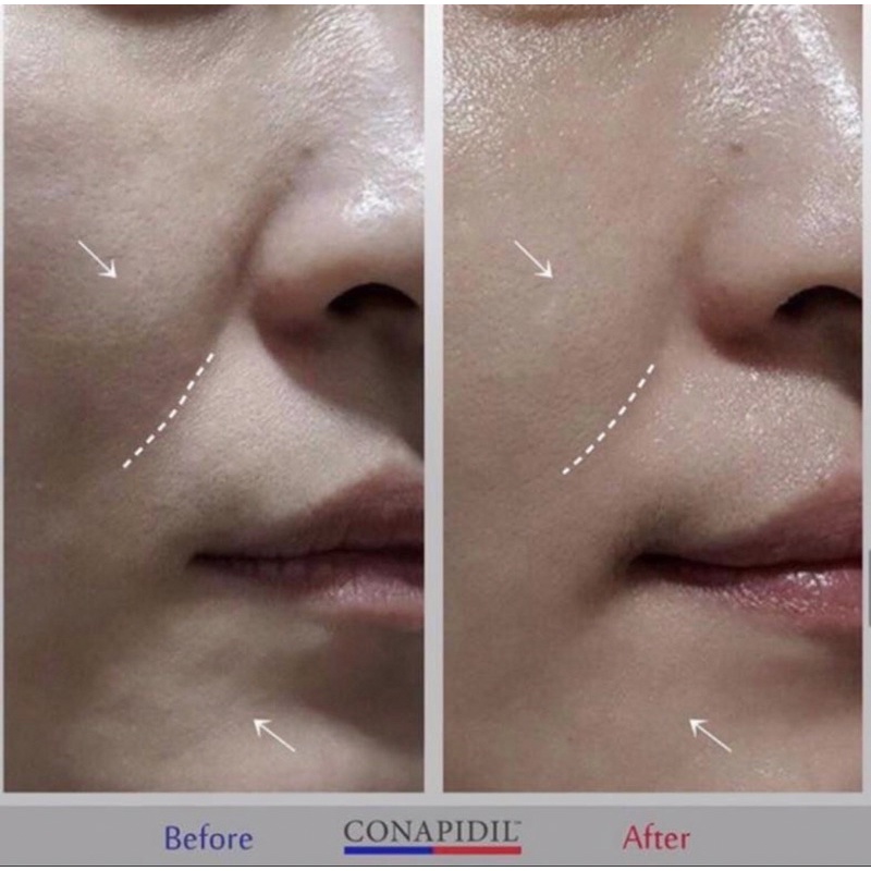 Kem tái định vị da Cemenzal. Kem đêm chuyên sâu chống lão hóa