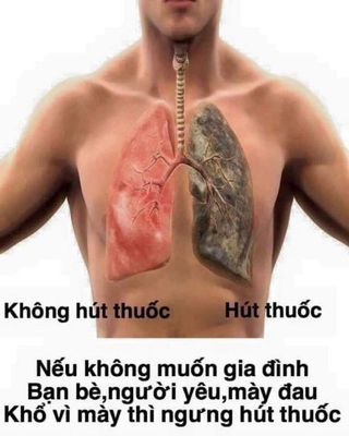 Cai thuốc lá No Smorking