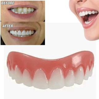 Perfect Instant Smile Comfort Fit Flex Giả Răng Giả Răng Mỹ Phẩm Nha Khoa