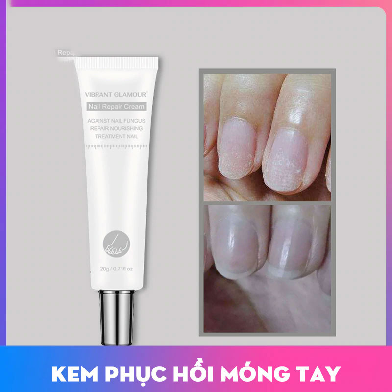 VIBRANT GLAMOUR KEM DƯỠNG MÓNG Phục Hồi Nấm Móng Phục Hồi Móng Chắc Khỏe