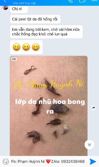 Body Active Peel 50ml: Peel hồng nhũ hoa và cô bé