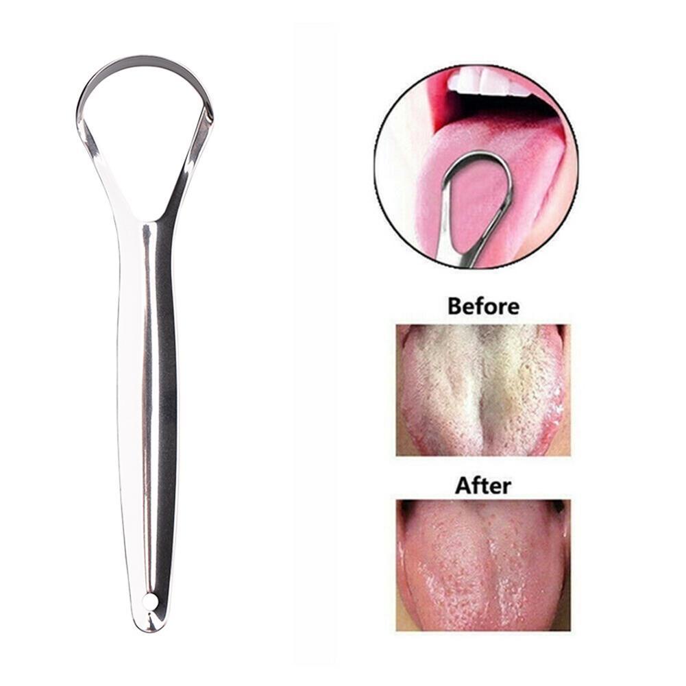 Dụng Cụ Cạo Lưỡi Bằng Thép Không Gỉ Chất Lượng Cao X1A6