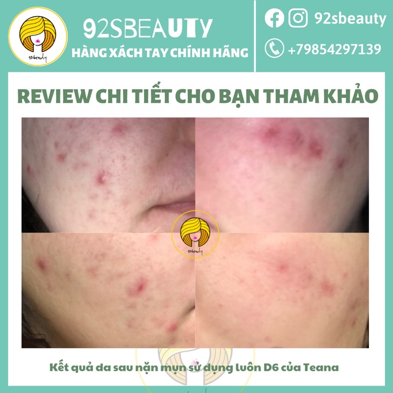 Serum Teana D6 Panthenol (B5) làm dịu, phục hồi, bảo vệ da