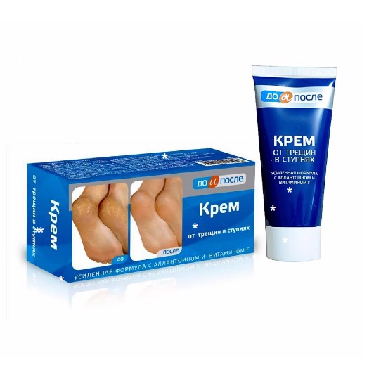 Kem Trị Nứt Gót Chân Nga Kpem 50ml