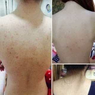 Sữa tắm than tre hoạt tính