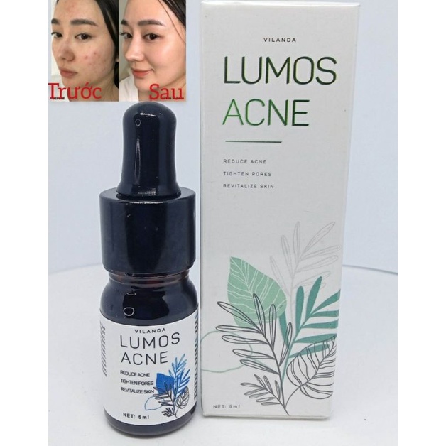 [ Chính hãng] Serum Mụn LUMOS ACNE 5ml Mỹ