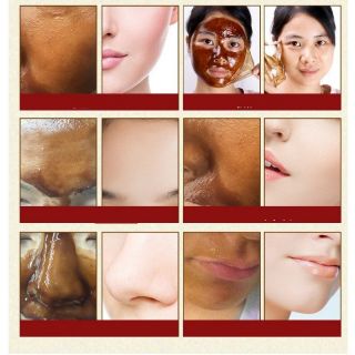 Gel lột mụn Organic