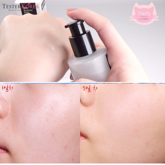 Tinh Chất Cosrx BHA Blackhead Power Liquid