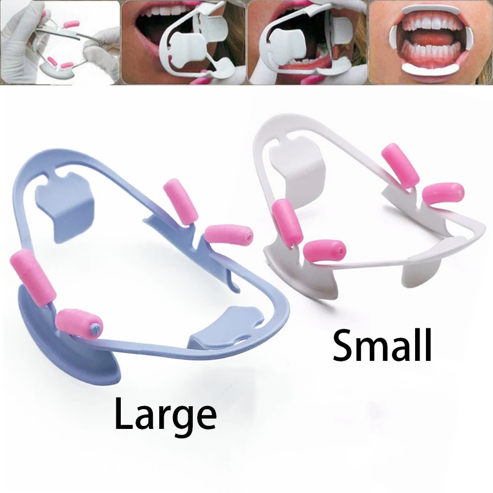 Dụng Cụ Mở Miệng Bằng Nhựa 3D Chuyên Dụng Cho Nha Khoa