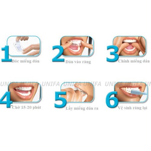Miếng dán trắng răng IVISMILE - Dán trắng răng, miếng dán răng an toàn - không bào mòn, không gây ê buốt cho răng