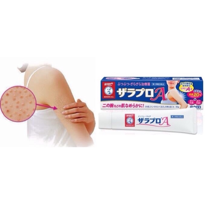 kem ngừa, giảm viêm nang lông của nhật 35g