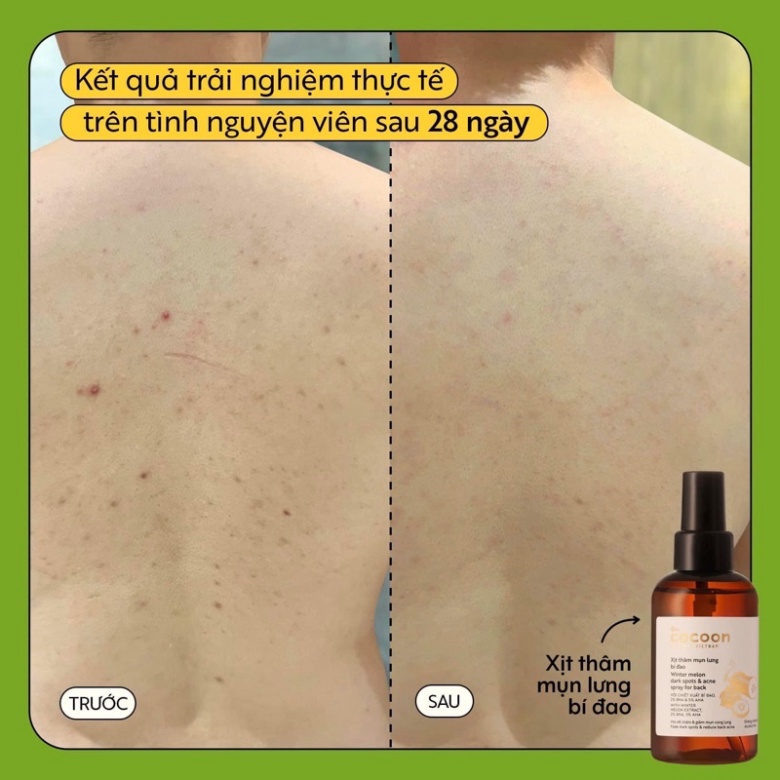 Xịt thâm mụn lưng bí đao Cocoon 140ml