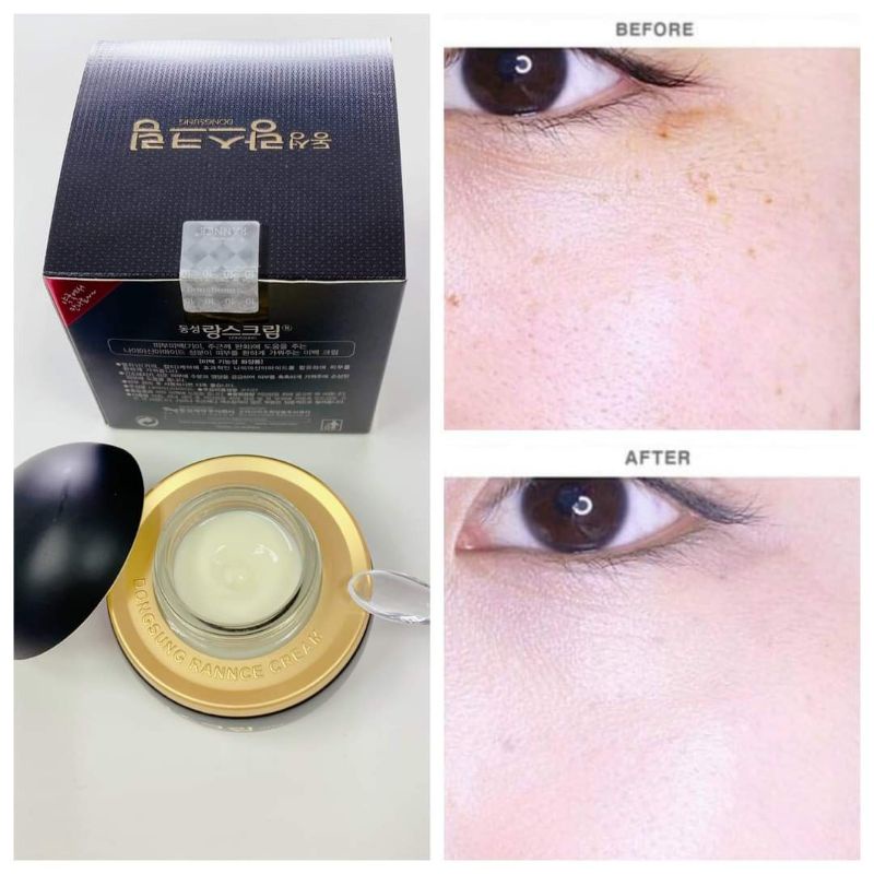 Kem Nám Dongsung Mẫu Cũ Hàn Quốc Hộp 70g