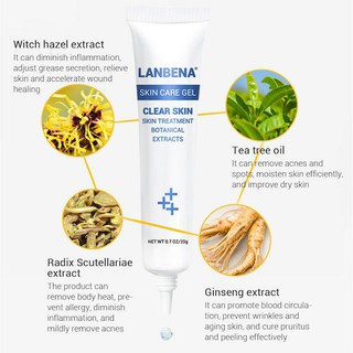 Kem Trị Mụn Thần Thánh LANBENA 20g