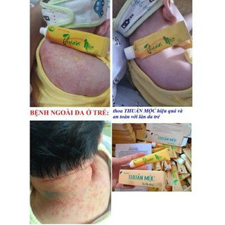 Kem bôi da Thuần khắc tinh của da Mộc