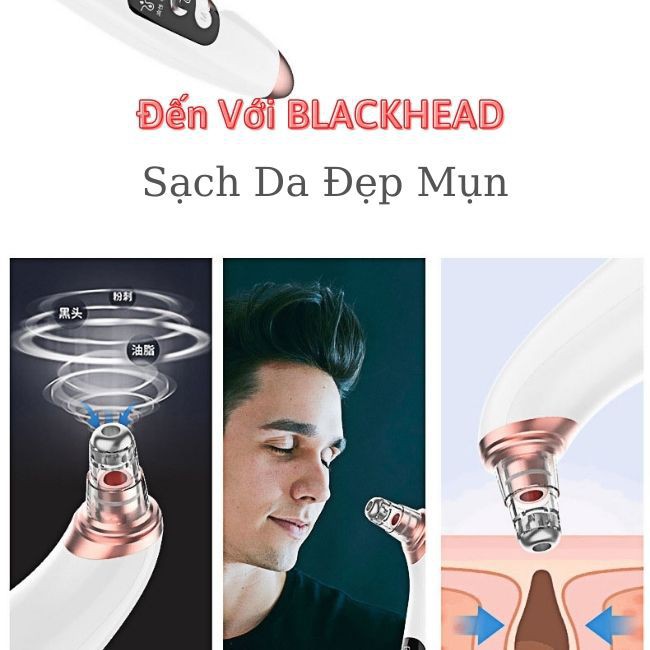 Máy hút mụn|Máy hút mụn đầu đen,mụn cám siêu sạch,siêu mạnh  Blackhead instrument | BigBuy360 - bigbuy360.vn