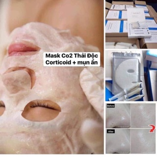 Mặt nạ thải độc CO2 Carbon Therapy