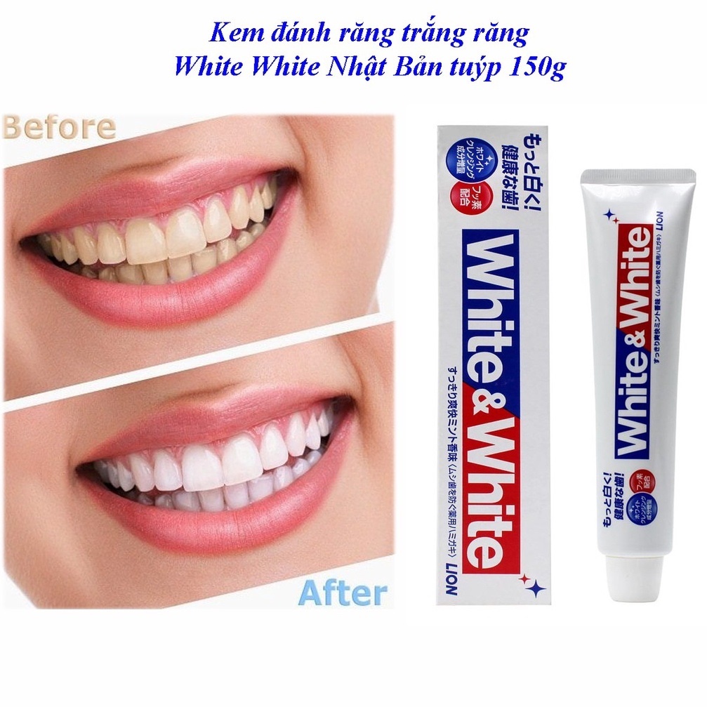 Kem đánh răng White &amp; White Lion Nhật Bản làm trắng răng, hơi thở thơm mát 150g