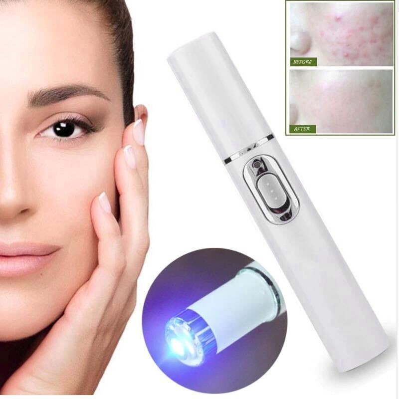 (Hàng Mới Về) Bút Xóa Sẹo Mụn Bằng Ánh Sáng Xanh Thiết Kế Nhỏ Gọn Tiện Dụng