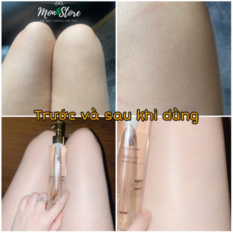 DẦU DƯỠNG ẨM toàn thân VV Natural Cosmetic giúp da căng mướt, bóng khỏe, hỗ trợ giảm viêm lỗ chân lông