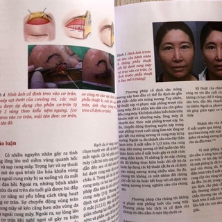 Tài Liệu Tham Khảo (Treo Cung Mày )