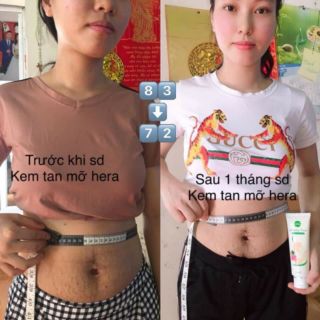 Kem Tan Mỡ HERA
