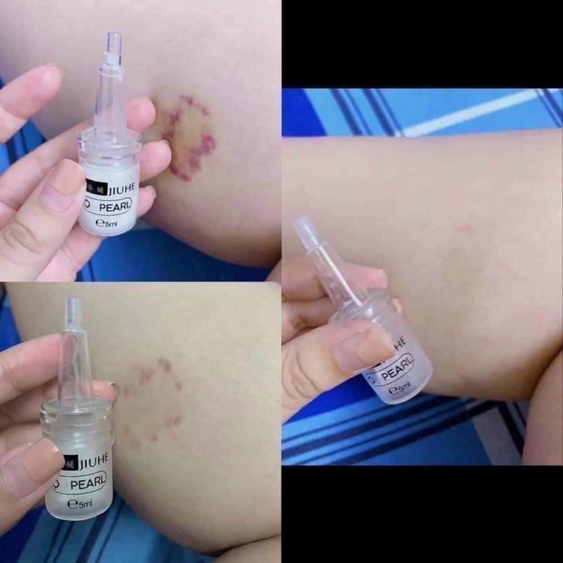 SERUM JIUHE BYE BYE MELANO THANH TÔ CHÍNH HÃNG 100%