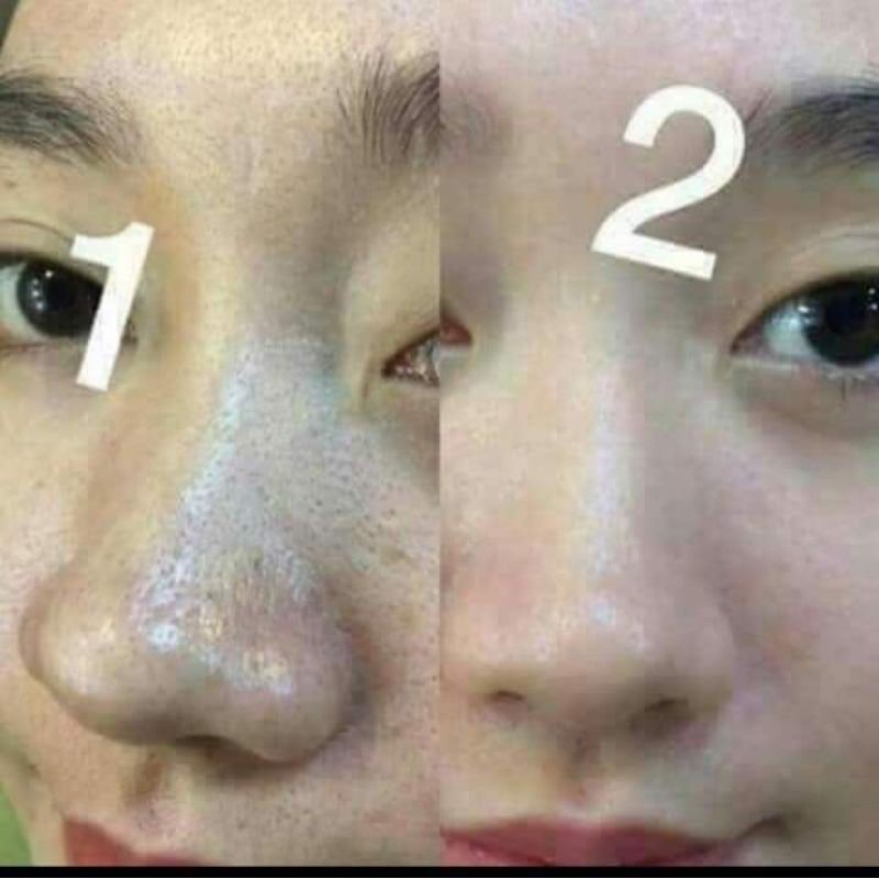 Bột Đánh Nám Tàn Nhang (gồm 2 bột và 1 lọ collagen đặc) | BigBuy360 - bigbuy360.vn