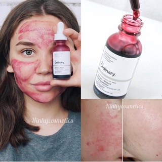 [Ordinary] Tẩy Da Chết The Ordinary AHA 30% + BHA 2% Peeling
