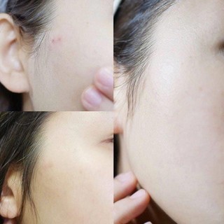 Nước thần sữa dưỡng sake Kuramoto