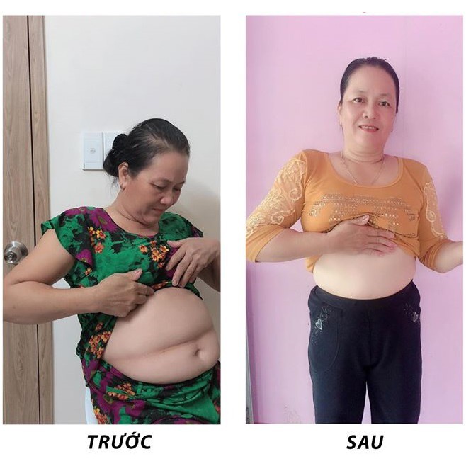 [Chính hãng] Gel thoa khử mỡ thảo dược The Miracle | BigBuy360 - bigbuy360.vn