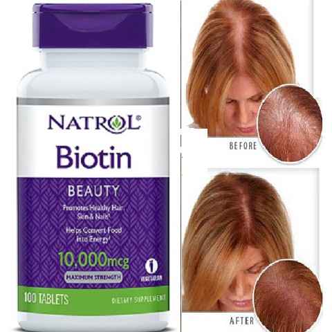 Viên Uống Mọc Tóc Natrol Biotin 10000 Mcg Của Mỹ 100 Viên