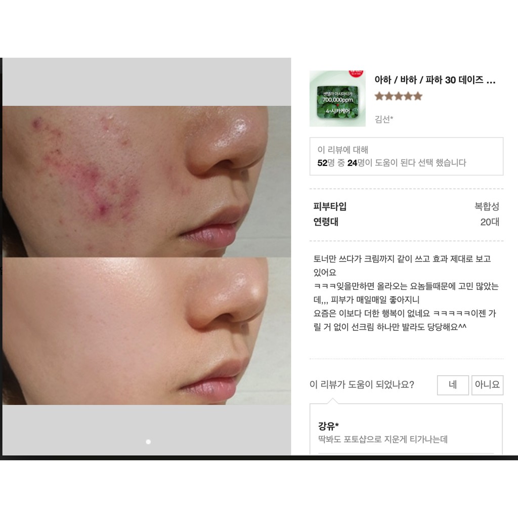 Bộ 3 món dưỡng da Some By Mi AHA- BHA-PHA 30 Days Miracle FULLSIZE | BigBuy360 - bigbuy360.vn