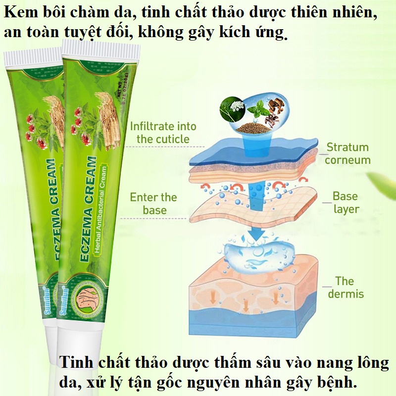 Kem hỗ trợ bôi chàm ngứa ECZEMA, tinh chất thảo dược thiên nhiên
