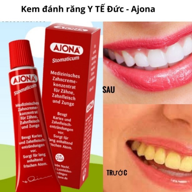 KEM ĐÁNH RĂNG  Y TẾ AJONA 25ML