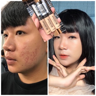 che khuyết điểm thesamee( hag chuẩn)