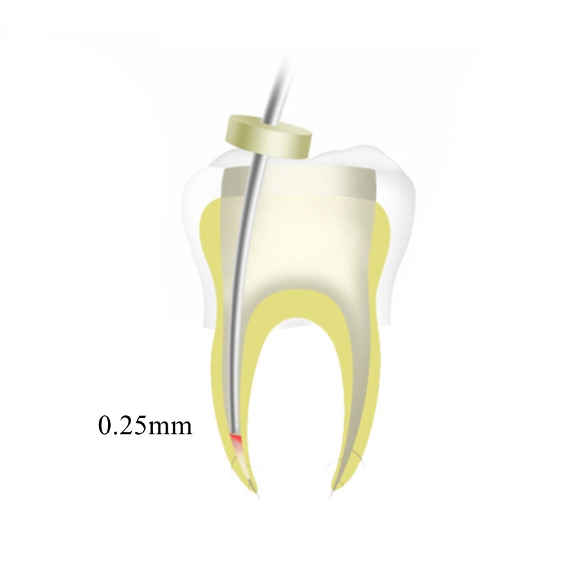 Bút Keo Nóng Chảy Mực Nha Khoa Kèm 2 Kim Sưởi Ấm