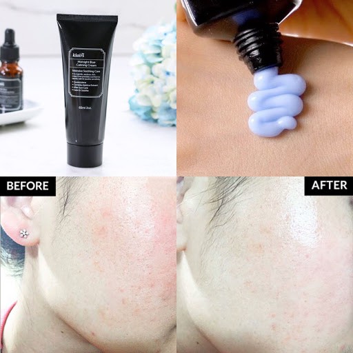 Kem Dưỡng Phục Hồi Da Ban Đêm Klairs Midnight Blue Calming Cream