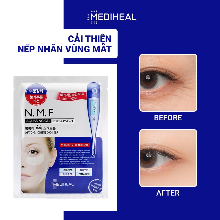 [Nhập mã COSMH22 giảm 8%] Mặt Nạ Cấp Ẩm Cho Mắt Mediheal N.M.F Aquaring Gel Eye Fill Patch Hộp 5 Túi [K32]