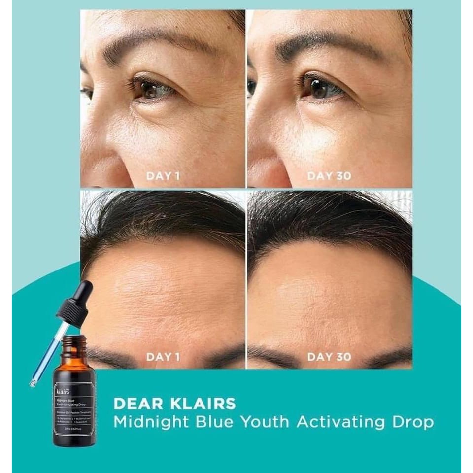 Serum Phục Hồi Da Dầu Mụn Nhạy Cảm Klairs Midnight Blue 20ml | BigBuy360 - bigbuy360.vn