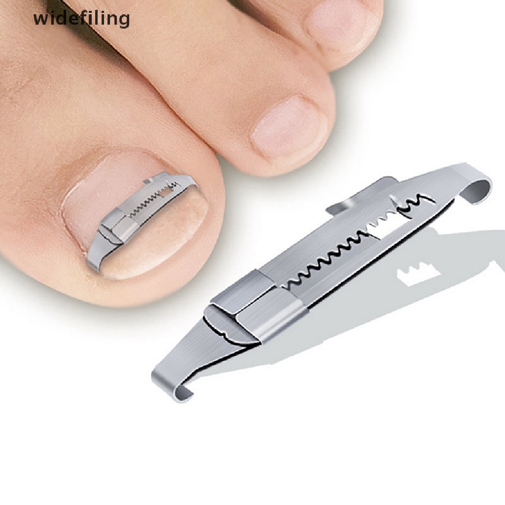 Dụng Cụ Hỗ Trợ Giảm Bệnh Nấm Móng Chân Tiện Lợi