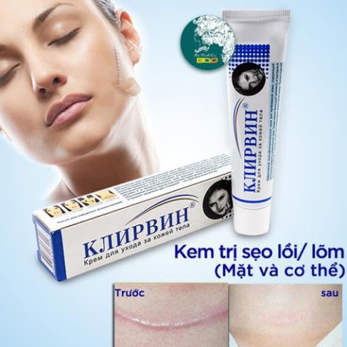 Kem bôi sẹo lồi Klirvin chính hãng Của Nga Kjinpbnh 25Gram  - HAVU Beauty